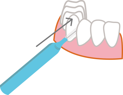 歯間ブラシの使い方