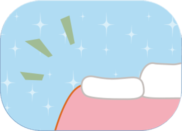 永久歯生え替わり時期の歯みがきは難しい！