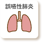 誤嚥性肺炎